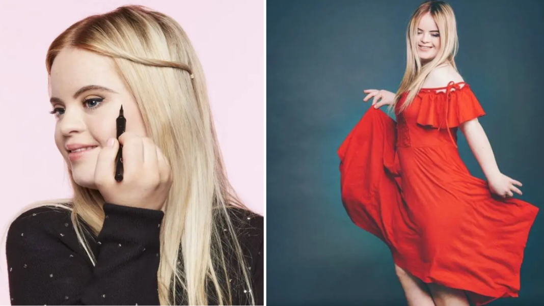 Model With Down Syndrome Becomes 